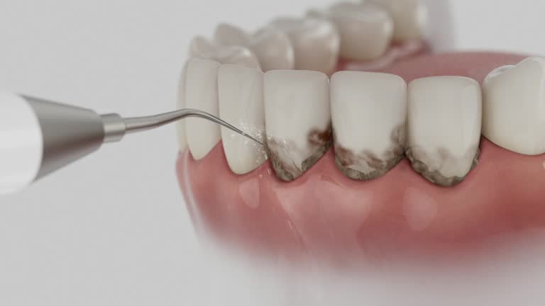Reliable Dental contractor in Sparta, MI by Dentist Open Now
